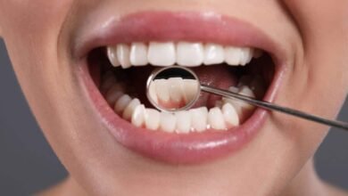 Best fix for missing teeth: Dental implants vs dentures, key differences between the two