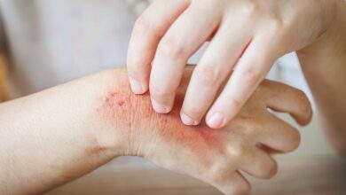 Frustrated By An Itchy Rash? Scratching Might Be Good For You After All; This Study Reveals Its Benefits