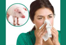 Swine Flu Spikes in India: Symptoms, Precautions, And More