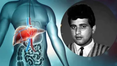 Manoj Kumar Death: What Is Decompensated Cirrhosis, the Iconic Actor Was Battling? Know What Causes It