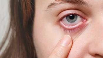 Eye Cancer: Expert explains causes, symptoms, and treatment options for this deadly disease