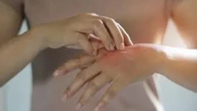 Surge in hand